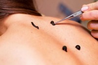 отдых лечение для пенсионеров - Набережные Челны 2021 Набережные Челны посоветуйте недорогой санаторий - Санаторий «Жемчужина»